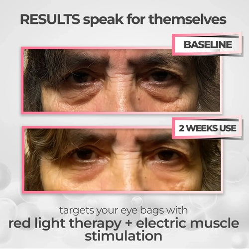 https://cdn.dropmagic.ai/medias/2a6996e9-cc78-4933-95b6-e63a29b5375a.webp